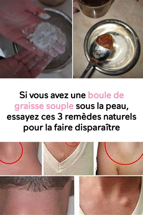 Les bosses sur un chien peuvent être très petites ou énormes. Si vous avez une boule de graisse souple sous la peau ...