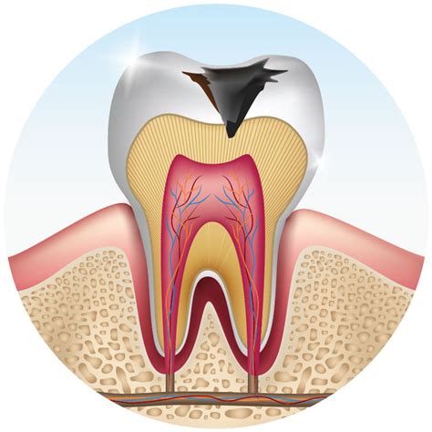 Just swish it around near the tooth for as long as you can. How To Sleep With A Toothache - Help You Rest Sleep