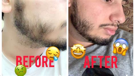 Grow a stronger, thicker, fuller beard faster with beardilizer beard products: Lumberman Premier Beard & Hair Growth Vitamin Formula ...