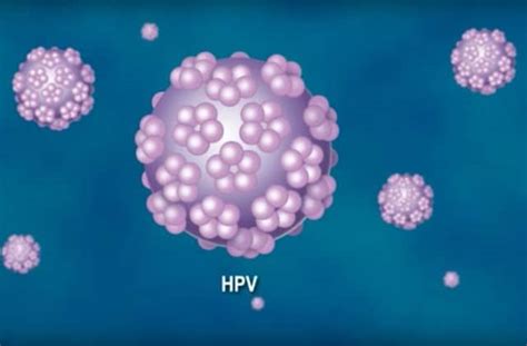 Human papillomavirus vaccination for adults: Le Papillomavirus Humain (VPH), symptômes et soins ...