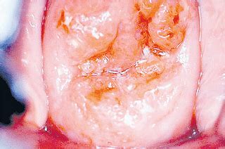 Efek manfaat dari bercinta sangat luar biasa. ~M@M@ T0t0!~