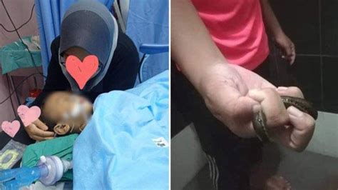 Mereka menghisap darah sebagai makanan untuk bertahan hidup. Bocah Laki-laki Kehilangan Banyak Darah, Setelah Anusnya ...