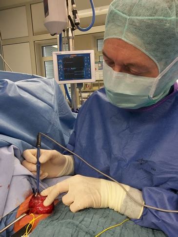 Falls die kleinen nebenschilddrüsen an dem schilddrüsengewebe anhaften und nur über diese mit blut versorgt wurden, retten wir die nebenschilddrüsen und pflanzen sie in eine eigens. Schilddrüsen-OP: aber sicher! - Fränkisch gesund