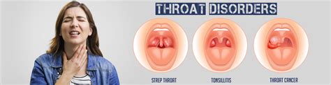 It can be infected and look like tonsillitis. Throat Disorder - Kamasutra Porn Videos
