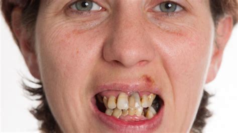 Cr7) santo antónio, portugal'de doğmuştur. Extrem schön: Krasse Verwandlung der Schwestern ...