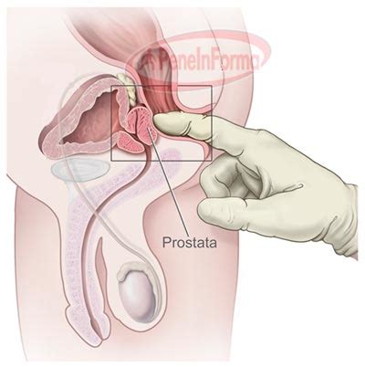 To work properly, the prostate needs male hormones (androgens). facciamodasoligrazie: LEZIONI DI SESSO - VIDEO DI SESSO ...