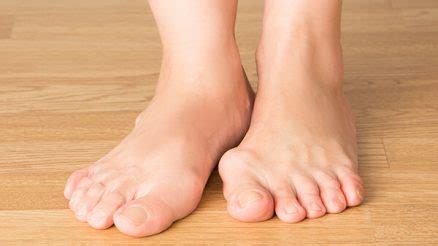 Fix your flat feet with these 6 simple exercises. How To Fix Flat Feet Without Surgery: 13 Treatments To Try