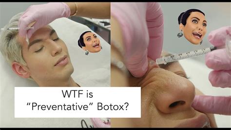 We did not find results for: First Time Getting Botox to Prevent Wrinkles... Does it ...