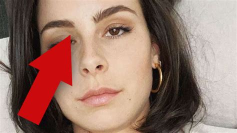 Ob sie den passenden partner. Lena Meyer-Landrut: Was ist mit ihrem Auge los? Irgendwas ...