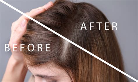 Hair follows a specific growth cycle with three distinct and concurrent phases: 05 Best And Effective Home Remedies for Hair Loss ...