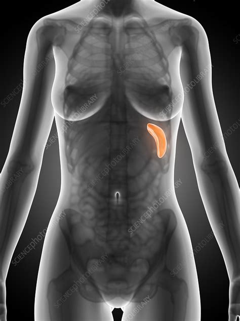 One of the most likely causes of an enlarged spleen is an infection, since swelling in the spleen signifies an increase in white blood cells that are trying to attack something threatening. Human spleen, illustration - Stock Image - F010/7077 ...