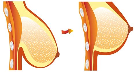 Mature blonde breast in a massage parlor. Prevent Sagging Breasts Naturally with THESE Tips ...