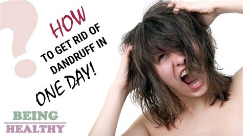 Maybe you would like to learn more about one of these? How To Get Rid Of Dandruff In One Day - YouTube