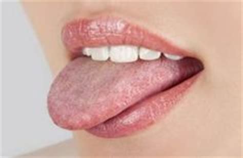 Muguet bouche adulte de plus, ces lésions se développent avec le temps, tandis que les lésions du muguet buccal peuvent. 129 Best Burning Tongue Syndrome images | Tongue sores ...