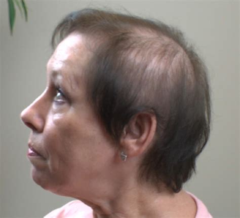 We did not find results for: Great Haircuts For Older Women With Thinning Hair : 25 ...