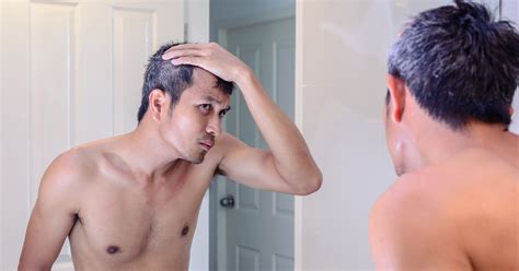 Other medications that can cause hair loss. Hair Loss on Temples: Causes and Treatment