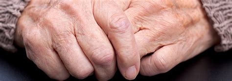 The 4 stages of rheumatoid arthritis progression. What Is Rheumatoid Arthritis Remission? | New Health Advisor