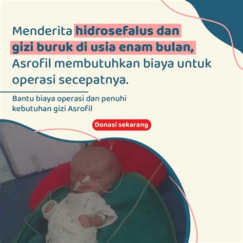 Meski demikian, perbedaan tinggi badan akibat stunting ini cenderung akan mencolok. Ketahui Ciri Stunting pada Anak! - WeCare.id