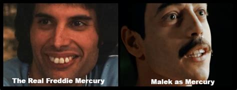 In real life, mercury really did have four extra teeth in the back of his mouth, pushing the front ones the director of freddie mercury: Would Invisalign Have Been an Option for Freddie Mercury ...