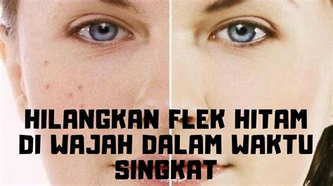 Simak terus tips dan cara menghilangkan bintik hitam di wajah di bawah ini! Cara Menghilangkan Flek Hitam Di Wajah Yang Membandel ...