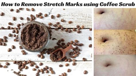 The caffeine in the coffee scrubs stimulates the flow. How to Remove Stretch Marks using Coffee Scrub
