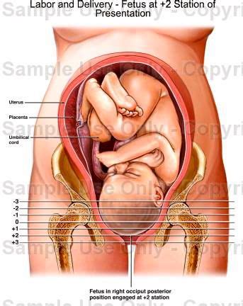 Let pacii teach you how to find your cervix (hellllooooo. 33 best images about Progress in Labor on Pinterest ...