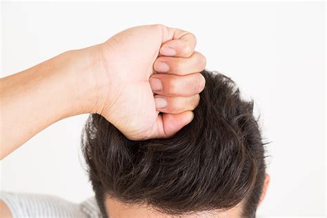 ヘアスタイルカタログ: 最高 つむじ かゆい 原因
