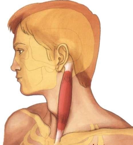 What is the prevalence of torticollis? Tortícolis, causas y tratamiento - Taringa!