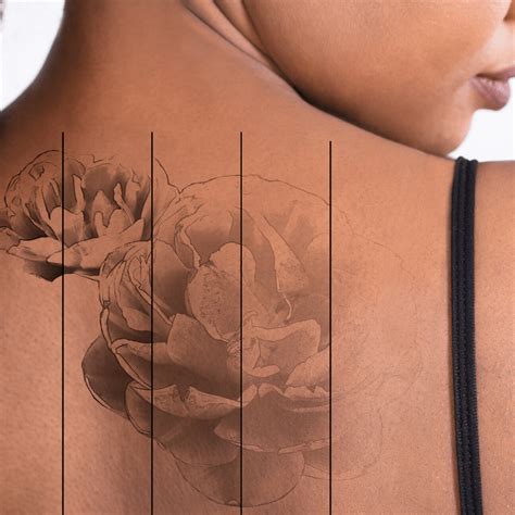 The wrecking balm is a great way to get rid of a tattoo at home without any pain. Laser Tattoo Removal in New York City | Park Avenue Skin Care