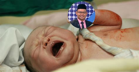 Walau bagaimana pun, tali pusat perlu dijaga bagi mengelakkan berlakunya jangkitan. Tali Pusat Terbelit Pada Leher Bayi Tiada Kaitan Dengan ...