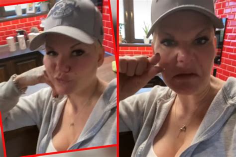 Trotz aller risiken ist die op unverzichtbar, denn schon lange hat der manager durch die verrutschten bandscheiben mit gesundheitlichen problemen. Beauty-OP! Melanie Müller legt sich unters Messer | TAG24