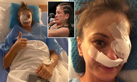 Karolina kowalkiewicz reacts to her. Kowalkiewicz hopes MMA career isn't over after eye surgery ...