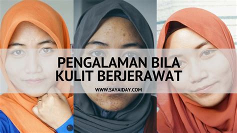 Klik krim spf untuk cara elak sinaran uv. Pengalaman Kulit Muka Berjerawat (Punca Jerawat)