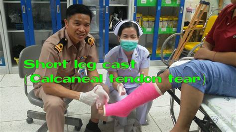 Tendinitis/tendonitis is inflammation of a tendon. Short leg cast(case tear TA tendon)by "RAKE" Krittanai ...