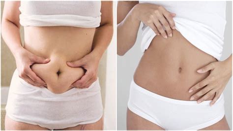 See more of cabinet de chirurgie esthétique sud toulouse on facebook. Chirurgie esthetique ventre et abdomen prix pas cher Tunisie