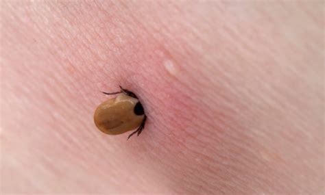 La maladie de lyme est une maladie vectorielle et une zoonose (maladie infectieuse touchant l'être humain et de nombreux animaux). Tutoriel pour identifier les tiques porteuses de la ...