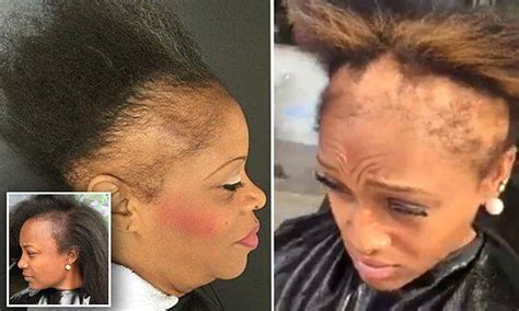 We men tend to think that we'll age 'gracefully' with a head full of hair past our prime. Hairstylist warns about how damaging weaves can be ...