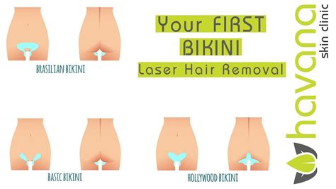 The basics of bikini hair removal. Hollywood brazilian laser hair removal (Görüntüler ile)