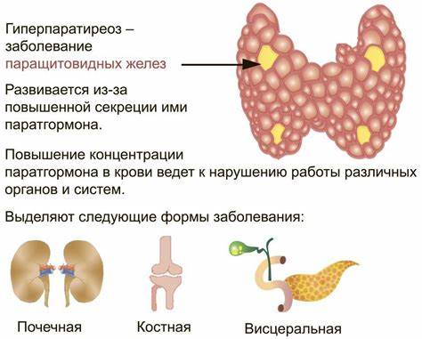 Диета при гиперпаратиреоз Что такое первичный гиперпаратиреоз, чем грозит и как лечить Что такое первичный гиперпаратиреоз, чем грозит и как лечить Диета при гиперпаратиреоз