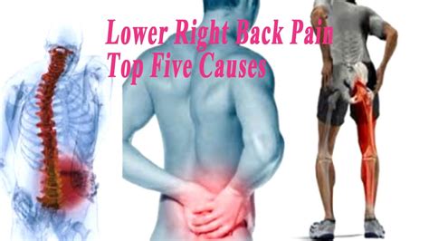 Your pain may originate in your lumbar spine (low back) or your hip—or both—and it's important that your doctor identifies the source of the problem, so you receive the right treatment. Lower Right Back Pain - Top Five Causes of Lower Back Pain ...