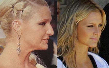 Check spelling or type a new query. 410 besten CELEBRITY-PLASTIC SURGERY, ETC. Bilder auf ...