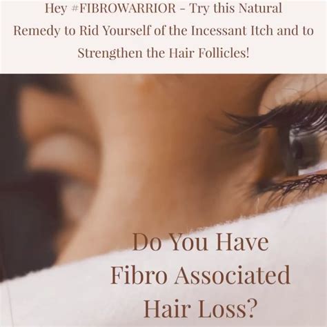 Stress can cause hair loss in some people. Pin on fibromyalgia