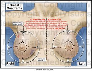 Each breast has 15 to 20 sections, called lobes. Breast Quadrants Medical Illustration Medivisuals