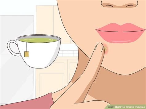 Fortunately, there are lots of ways to get rid of a pimple. How to Shrink Pimples: 13 Steps (with Pictures) - wikiHow