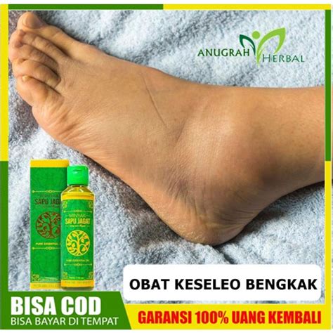 Opsi teraman untuk mengobati pembengkakan akibat keseleo adalah memilih pengobatan rumahan. Obat Tradisional Untuk Bengkak Akibat Kesleo / Gambar Kaki ...