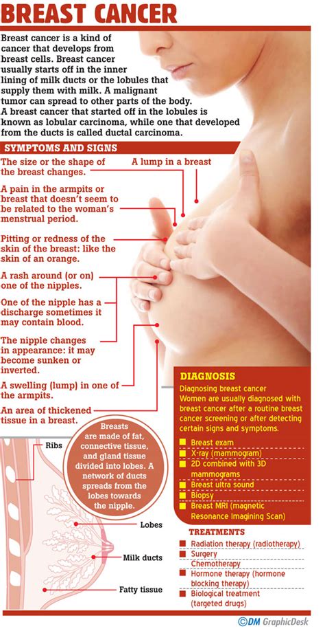 Common types of breast cancer include ductal carcinoma in situ, invasive ductal carcinoma, inflammatory breast cancer, and metastatic breast cancer. Daily Mirror - Breast cancer