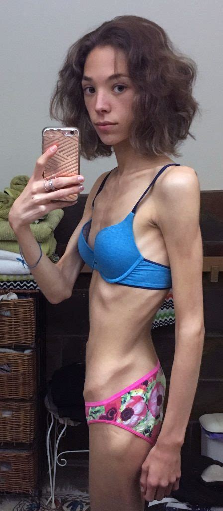 Hot ginger milf anna bell peaks has a hot and wet christmas present for you. » Anorexic 5st 5lbs dancer who ate only an apple a day ...