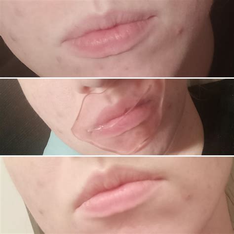 How can i protect and restore my collagen. review KNC Beauty Collagen Lip Mask : SkincareAddiction