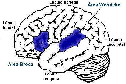 A extensão progressiva da necrose, que envolve o cérebro, pode causar sinais de trombose do seio cavernoso, convulsões, afasia, ou hemiplegia. Afasia Progressiva Primária - Sintomas e Exames | Cultura Mix