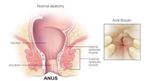 Bagian komputer yang satu ini adalah bagian terluar yang fungsinya melindungi beragam perangkat penting yang membuat komputer bisa dioperasikan. Anus : Pengertian, Fungsi, Struktur dan Bagian Terlengkap